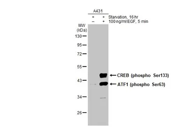 Anti-CREB (phospho Ser133) antibody used in Western Blot (WB). GTX130379