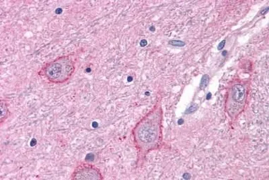 Anti-mGluR3 antibody used in IHC (Paraffin sections) (IHC-P). GTX13041