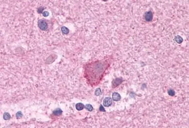 Anti-mGluR3 antibody used in IHC (Paraffin sections) (IHC-P). GTX13041