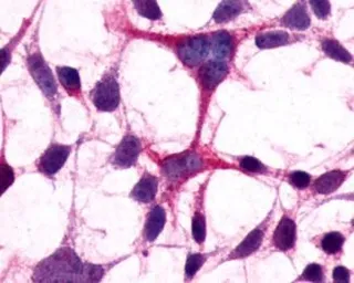 Anti-mGluR3 antibody used in Immunocytochemistry/ Immunofluorescence (ICC/IF). GTX13041