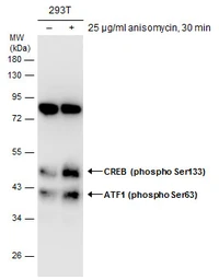 Anti-ATF1 (phospho Ser63) antibody used in Western Blot (WB). GTX130420