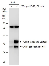 Anti-ATF1 (phospho Ser63) antibody used in Western Blot (WB). GTX130420