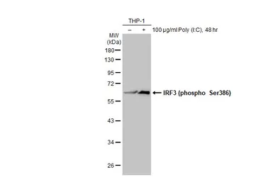 Anti-IRF3 (phospho Ser386) antibody used in Western Blot (WB). GTX130422