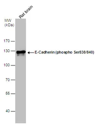 Anti-E-Cadherin (phospho Ser838/840) antibody used in Western Blot (WB). GTX130427