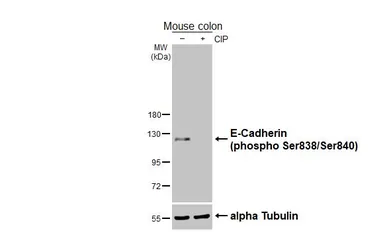 Anti-E-Cadherin (phospho Ser838/840) antibody used in Western Blot (WB). GTX130427