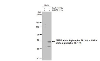 Anti-AMPK alpha 1 (phospho Thr183) + AMPK alpha 2 (phospho Thr172) antibody used in Western Blot (WB). GTX130429