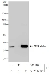 Anti-PP2A alpha antibody used in Immunoprecipitation (IP). GTX130434