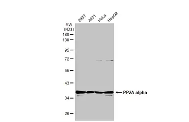 Anti-PP2A alpha antibody used in Western Blot (WB). GTX130434