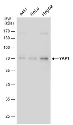 Anti-YAP1 antibody used in Western Blot (WB). GTX130444