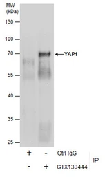 Anti-YAP1 antibody used in Immunoprecipitation (IP). GTX130444