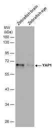 Anti-YAP1 antibody used in Western Blot (WB). GTX130444
