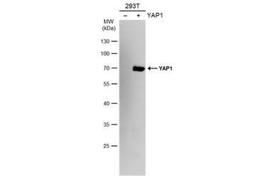 Anti-YAP1 antibody used in Western Blot (WB). GTX130444