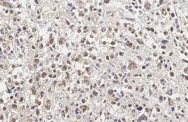 Anti-YAP1 antibody used in IHC (Paraffin sections) (IHC-P). GTX130444
