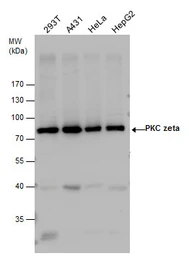 Anti-PKC zeta antibody used in Western Blot (WB). GTX130446