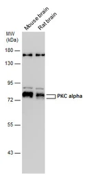 Anti-PKC alpha antibody used in Western Blot (WB). GTX130453