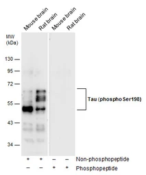 Anti-Tau (phospho Ser198) antibody used in Western Blot (WB). GTX130456