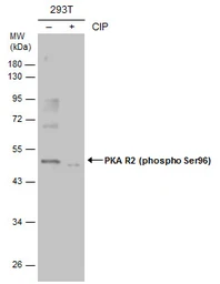Anti-PKA R2 (phospho Ser99) antibody used in Western Blot (WB). GTX130457