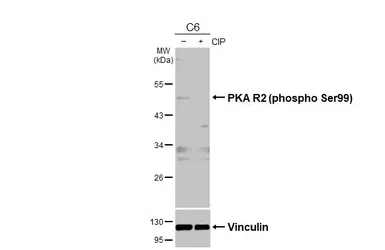 Anti-PKA R2 (phospho Ser99) antibody used in Western Blot (WB). GTX130457