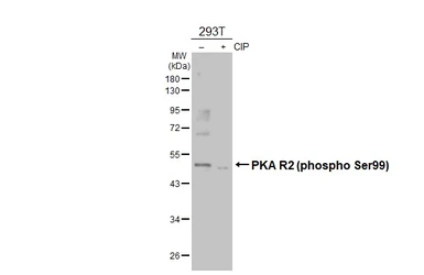 Anti-PKA R2 (phospho Ser99) antibody used in Western Blot (WB). GTX130457