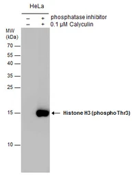 Anti-Histone H3T3ph (phospho Thr3) antibody used in Western Blot (WB). GTX130458