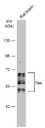 Anti-Tau antibody used in Western Blot (WB). GTX130462