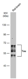 Anti-Tau antibody used in Western Blot (WB). GTX130462