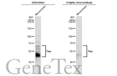 Anti-Tau antibody used in Western Blot (WB). GTX130462