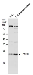 Anti-RPP25 antibody used in Western Blot (WB). GTX130473