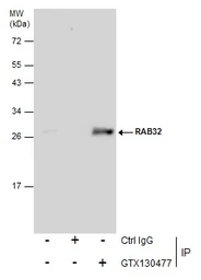 Anti-RAB32 antibody used in Immunoprecipitation (IP). GTX130477