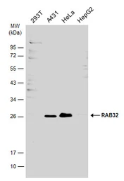 Anti-RAB32 antibody used in Western Blot (WB). GTX130477