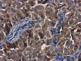 Anti-TDRD1 antibody used in IHC (Paraffin sections) (IHC-P). GTX130485