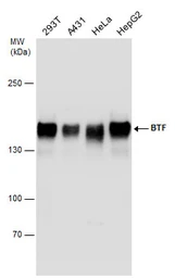 Anti-BTF antibody used in Western Blot (WB). GTX130490
