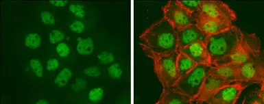 Anti-BTF antibody used in Immunocytochemistry/ Immunofluorescence (ICC/IF). GTX130490