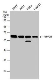 Anti-UPF3B antibody used in Western Blot (WB). GTX130493