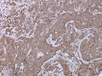 Anti-UPF3B antibody used in IHC (Paraffin sections) (IHC-P). GTX130493