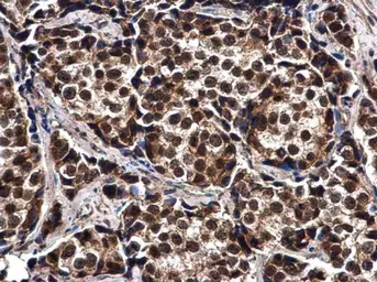 Anti-ELAC2 antibody used in IHC (Paraffin sections) (IHC-P). GTX130499