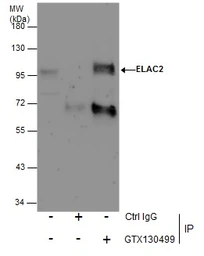 Anti-ELAC2 antibody used in Immunoprecipitation (IP). GTX130499