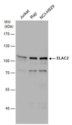 Anti-ELAC2 antibody used in Western Blot (WB). GTX130499