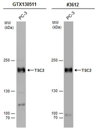 Anti-TSC2 antibody used in Western Blot (WB). GTX130511