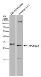 Anti-APOBEC2 antibody used in Western Blot (WB). GTX130521