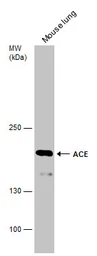 Anti-ACE antibody used in Western Blot (WB). GTX130534
