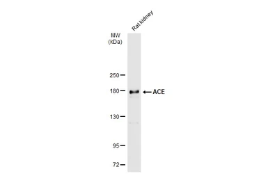 Anti-ACE antibody used in Western Blot (WB). GTX130534