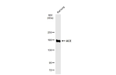 Anti-ACE antibody used in Western Blot (WB). GTX130534