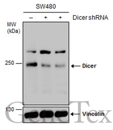 Anti-Dicer antibody used in Western Blot (WB). GTX130536