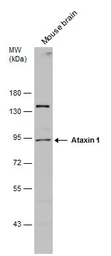 Anti-Ataxin 1 antibody used in Western Blot (WB). GTX130595