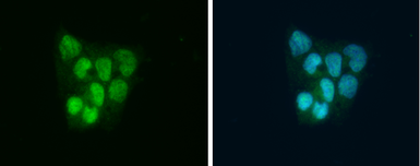 Anti-SLBP antibody used in Immunocytochemistry/ Immunofluorescence (ICC/IF). GTX130597