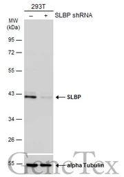 Anti-SLBP antibody used in Western Blot (WB). GTX130597