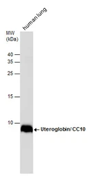 Anti-Uteroglobin antibody used in Western Blot (WB). GTX130640