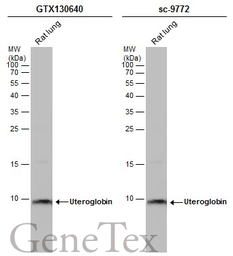 Anti-Uteroglobin antibody used in Western Blot (WB). GTX130640