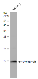 Anti-Uteroglobin antibody used in Western Blot (WB). GTX130640